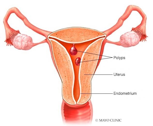 structure of a uterus-swheal